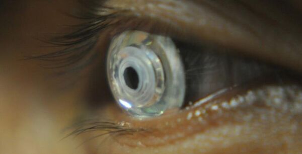The latest telescopic contact lens The latest telescopic contact lens - Sputnik International