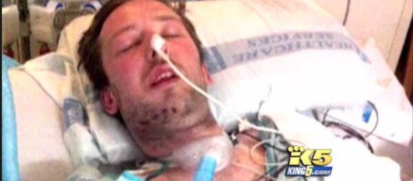 Dustin Theoharis had over twelve reconstructive surgeries after two officers shot him sixteen times over a mistaken identity - Sputnik International