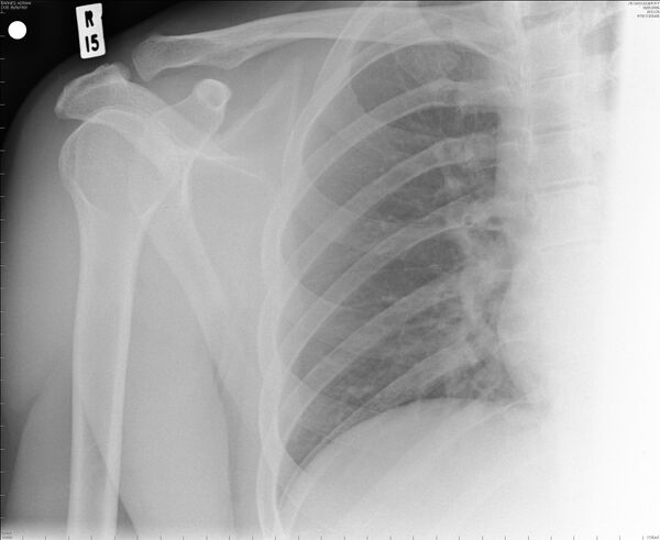 X-Ray - Sputnik International