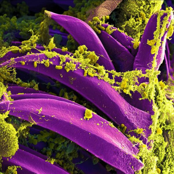 Scanning electron micrograph of Yersinia pestis, which causes bubonic plague, on proventricular spines of a Xenopsylla cheopis flea. - Sputnik International
