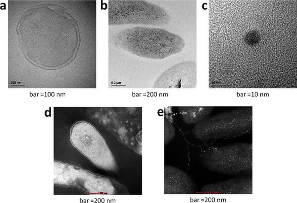 TEM (bright background) and STEM (dark background) of P. aeruginosa before (a and d) and after (b, c and e) treatment with silver; the black (b) and white (e) granules represent silver deposition which account for the zombies biocidal action. TEM (bright background) and STEM (dark background) of P. aeruginosa before (a and d) and after (b, c and e) treatment with silver; the black (b) and white (e) granules represent silver deposition which account for the zombies biocidal action. - Sputnik International