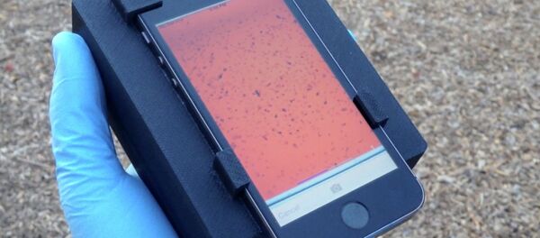 Researchers led by a team at the University of California, Berkeley, have developed the CellScope, a smartphone microscope capable of detecting parasites in a drop of blood - Sputnik International