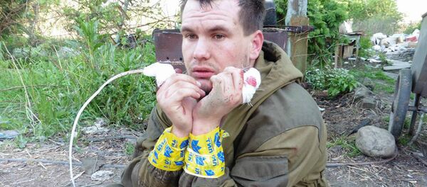 An image of what appears to be a Donbass milita fighter with his index fingers cut off by his Ukrainian captors. - Sputnik International