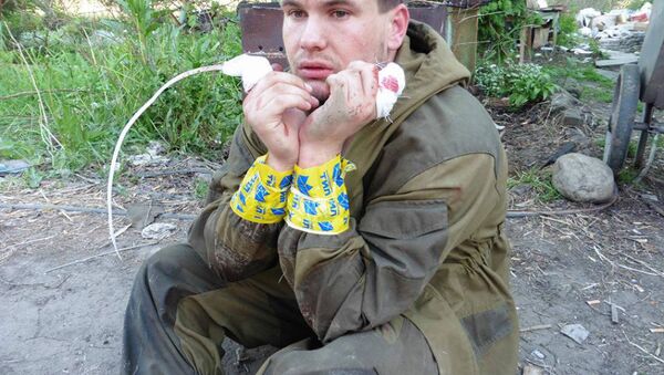 An image of what appears to be a Donbass milita fighter with his index fingers cut off by his Ukrainian captors. - Sputnik International
