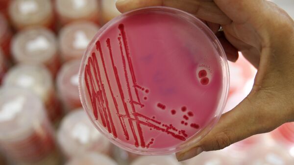 An analytical chemist shows a petri dish with salmonella in the Institute for Chemical and Veterinary Research in Stuttgart, southwestern Germany - Sputnik International