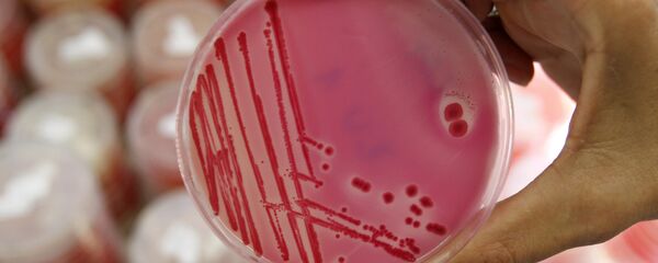An analytical chemist shows a petri dish with salmonella in the Institute for Chemical and Veterinary Research in Stuttgart, southwestern Germany - Sputnik International