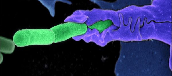 Deadly Delivery: US Military Mistakenly Shipped Out Toxic Anthrax Samples Deadly Delivery: US Military Mistakenly Shipped Out Toxic Anthrax Samples - Sputnik International