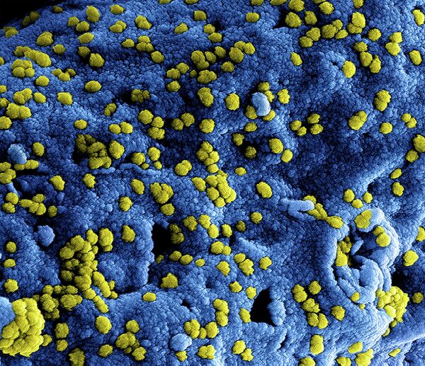 MERS Coronavirus Particles - Sputnik International