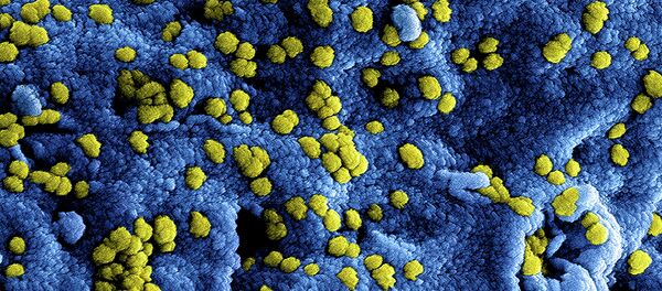 MERS Coronavirus Particles MERS Coronavirus Particles - Sputnik International