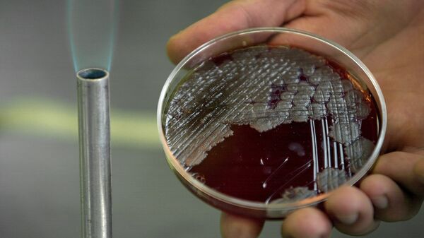 Sample of billions of Anthrax bacteria - Sputnik International