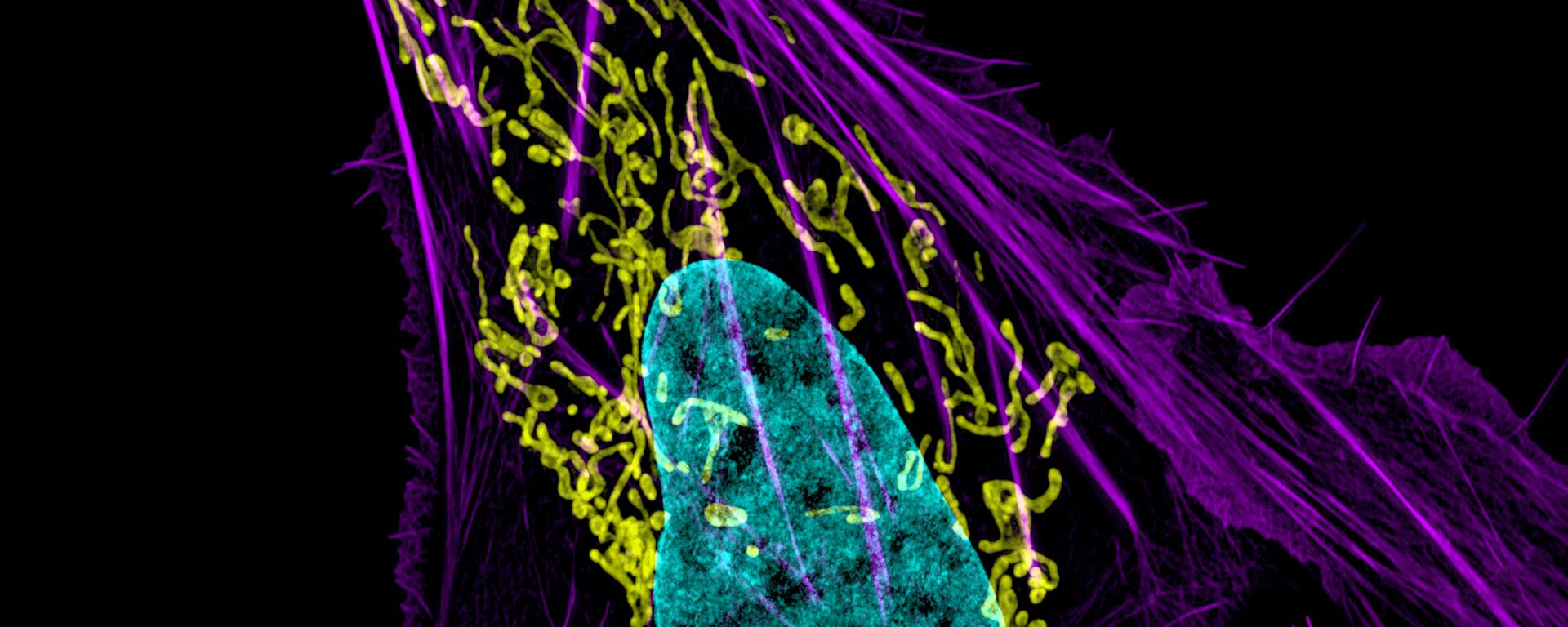 Cancer cell  - Sputnik International, 1920, 12.01.2021