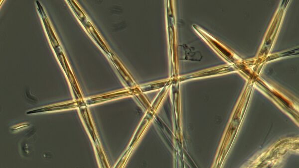 The algae pseudo-nitzchia, which produces the toxic domoic acid, is seen from an algae bloom sample that the NOAA ship Bell M. Shimada collected during its survey this summer on the West Coast. - Sputnik International
