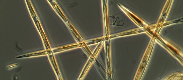 The algae pseudo-nitzchia, which produces the toxic domoic acid, is seen from an algae bloom sample that the NOAA ship Bell M. Shimada collected during its survey this summer on the West Coast. The algae pseudo-nitzchia, which produces the toxic domoic acid, is seen from an algae bloom sample that the NOAA ship Bell M. Shimada collected during its survey this summer on the West Coast. - Sputnik International