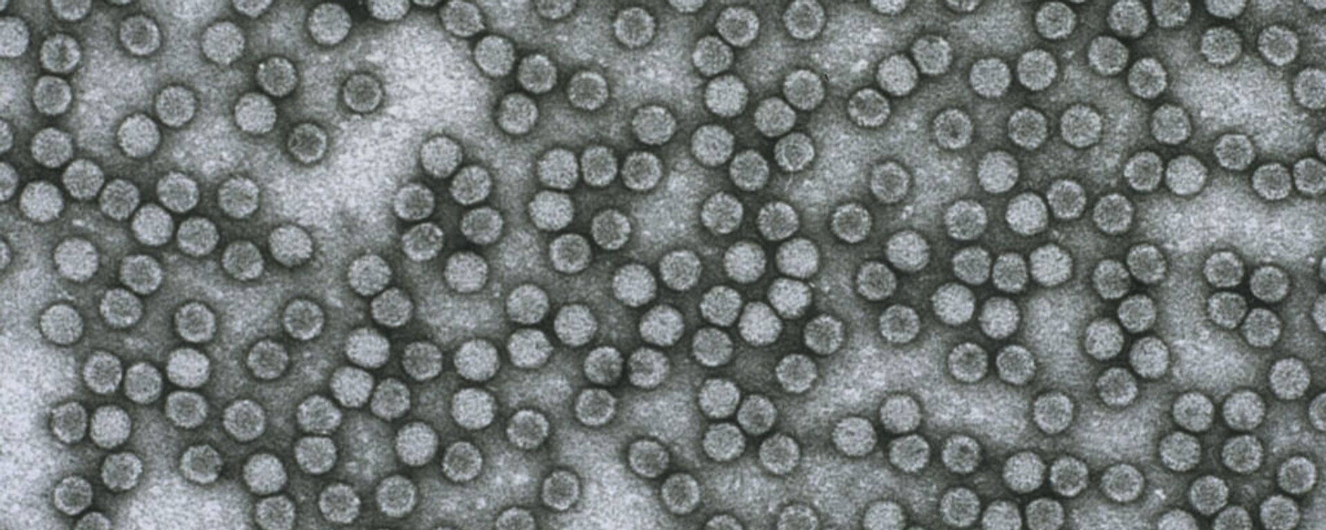 Polio virus (picornavirus) - Sputnik International, 1920, 16.06.2022