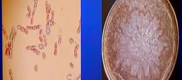 Ancient strain of bacteria deep in the Siberian permafrost Ancient strain of bacteria deep in the Siberian permafrost - Sputnik International