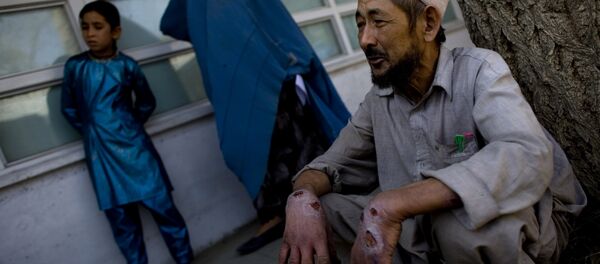 Leishmanisis disease Leishmanisis disease - Sputnik International