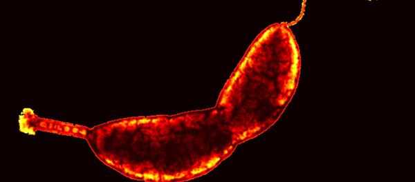 Caulobacter crescentus Caulobacter crescentus - Sputnik International