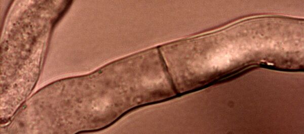 Hyphae of Neurospora crassa with septum and porus Hyphae of Neurospora crassa with septum and porus - Sputnik International