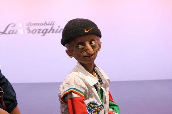 Indian teenager suffering from progeria passes away Indian teenager suffering from progeria passes away - Sputnik International