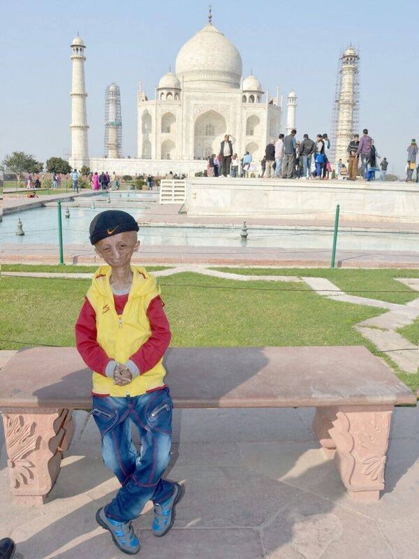 Indian teenager suffering from progeria passes away Indian teenager suffering from progeria passes away - Sputnik International