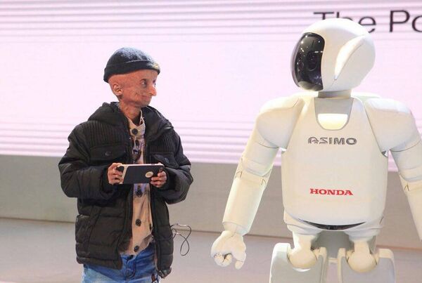 Indian teenager suffering from progeria passes away Indian teenager suffering from progeria passes away - Sputnik International