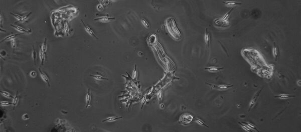 Amoeba Amoeba - Sputnik International