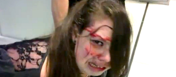 Disabled Woman Beaten Bloody by TSA - Sputnik International