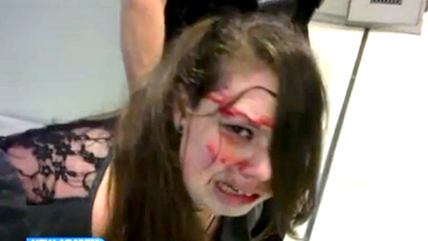 Disabled Woman Beaten Bloody by TSA - Sputnik International