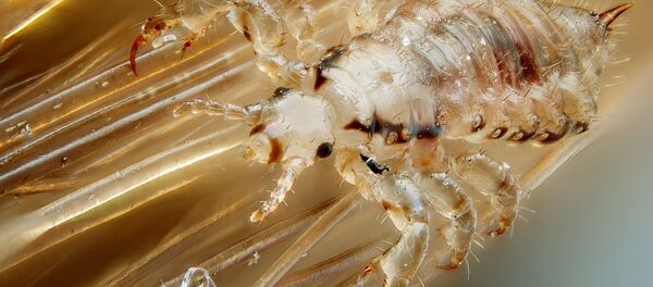 Male human head louse - Sputnik International