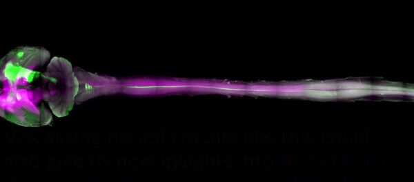 Mouse’s body made entirely transparent to reveal nervous system Mouse’s body made entirely transparent to reveal nervous system - Sputnik International