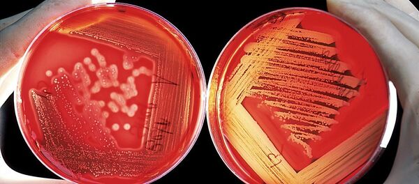 Blood cells - Sputnik International