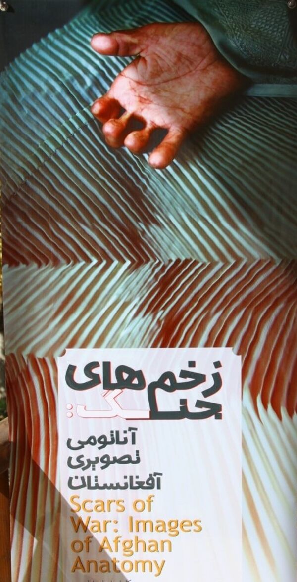 Afghanistan: the scars of war Afghanistan: the scars of war - Sputnik International