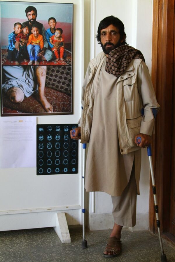 Afghanistan: the scars of war Afghanistan: the scars of war - Sputnik International