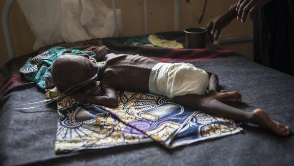 A young child suffering from severe malnutrition lies on a bed in the ICU ward at the In-Patient Therapeutic Feeding Centre in the Gwangwe district of Maiduguri, the capital of Borno State, northeastern Nigeria, on September 17, 2016 - Sputnik International