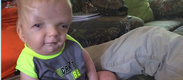 Terminally Ill Toddler Becomes Cruel Viral Meme, Mother Fighting to Stop It Spreading Terminally Ill Toddler Becomes Cruel Viral Meme, Mother Fighting to Stop It Spreading - Sputnik International