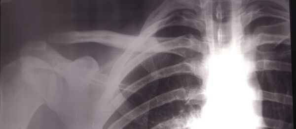 X-rays - Sputnik International