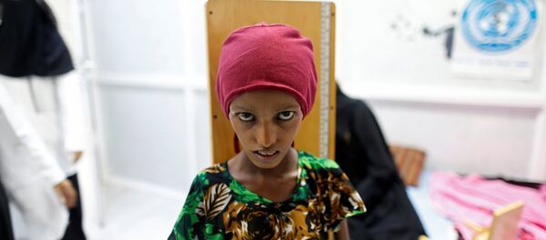 The starving people of Yemen. The starving people of Yemen. - Sputnik International