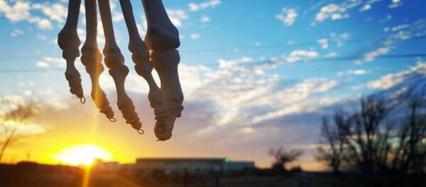 Cancer Survivor Creates Inspiring Instagram Page on Behalf of Her Amputated Foot Cancer Survivor Creates Inspiring Instagram Page on Behalf of Her Amputated Foot - Sputnik International