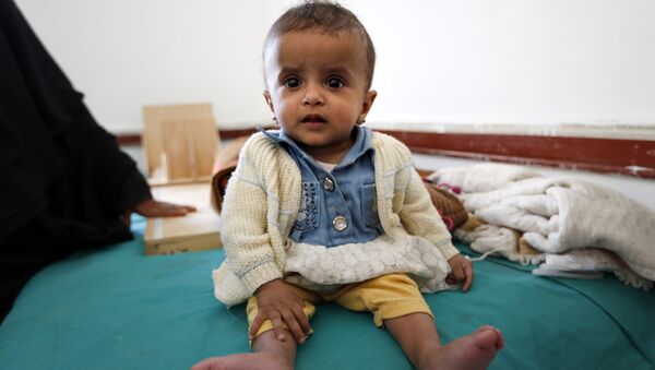A Yemeni infant suffering from malnutrition waits for treatment at a medical center in Bani Hawat, on the outskirts of the Yemeni capital Sanaa, on January 9, 2017. - Sputnik International