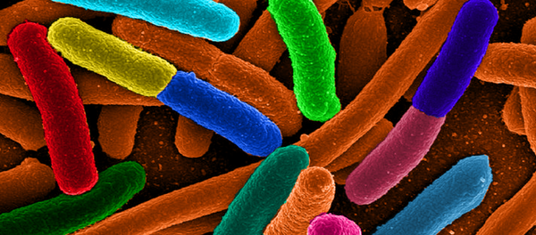 Escherichia coli Escherichia coli - Sputnik International