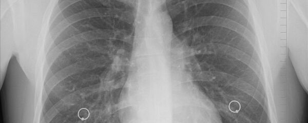 Lungs - Sputnik International