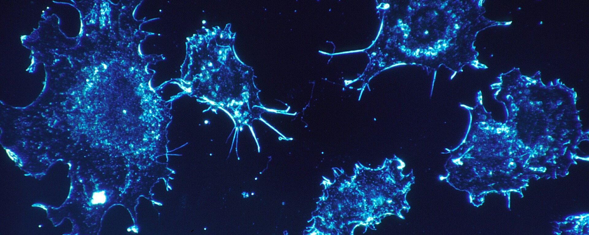 Cancer cells  - Sputnik International, 1920, 08.10.2020
