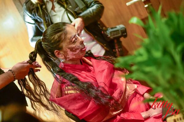 Acid Attack Survivors Fashion - Sputnik International