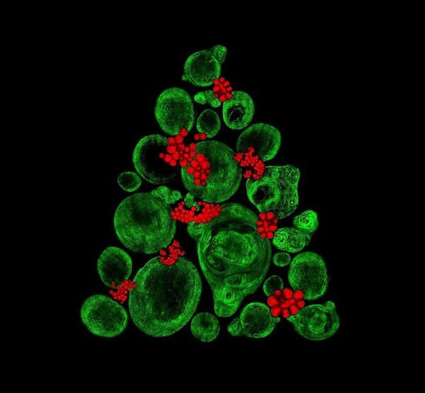A stem cell Christmas tree - Sputnik International