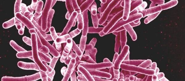 Mycobacterium tuberculosis bacteria Mycobacterium tuberculosis bacteria - Sputnik International