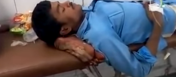 Investigation launched in India after patient's amputated leg was used as pillow - Sputnik International