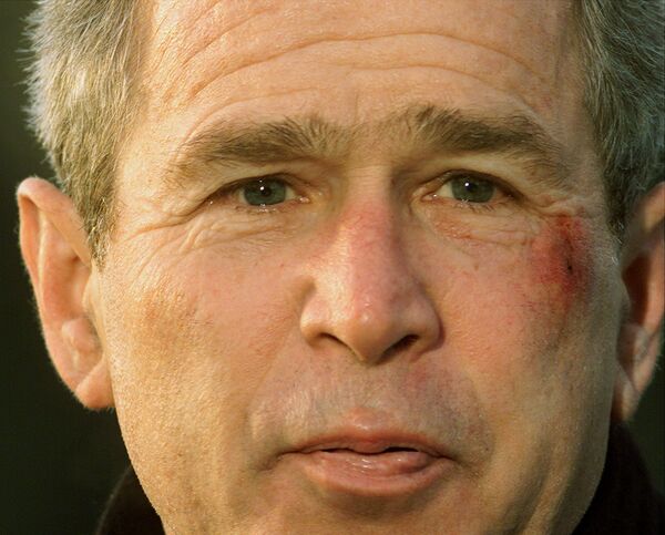 President Bush, with a scrape on his face, talks with reporters, Monday, Jan.14, 2002, at the White House about fainting briefly in the White House residence Sunday night President Bush, with a scrape on his face, talks with reporters, Monday, Jan.14, 2002, at the White House about fainting briefly in the White House residence Sunday night - Sputnik International