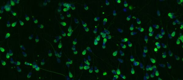 Bovine sperm viewed under a microscope. The sperm cells have been stained with fluorescent probes so that researchers can determine if the acrosome reaction (which helps prepare sperm cells for fertilization of an egg) has occurred in each cell Bovine sperm viewed under a microscope. The sperm cells have been stained with fluorescent probes so that researchers can determine if the acrosome reaction (which helps prepare sperm cells for fertilization of an egg) has occurred in each cell - Sputnik International