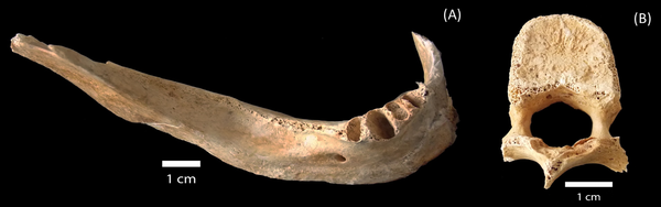 Victim’s mandible collected at Hirose and Nakahiro-machi Victim’s mandible collected at Hirose and Nakahiro-machi - Sputnik International