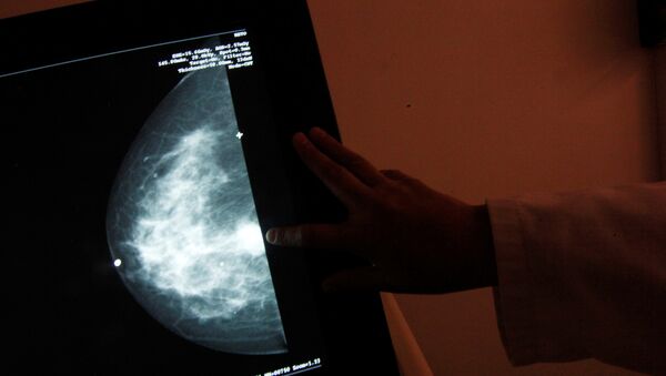 A monitor shows the image of a breast cancer (File) - Sputnik International